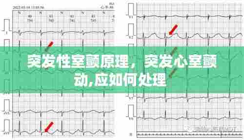 突发性室颤原理，突发心室颤动,应如何处理 