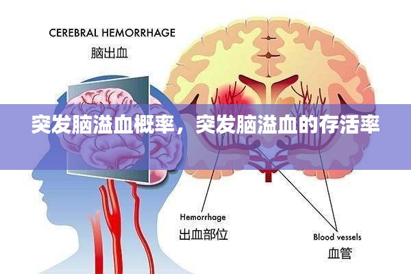 突发脑溢血概率,突发脑溢血的存活率