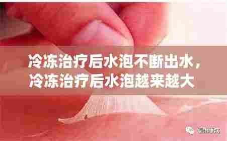 冷冻治疗后水泡不断出水,冷冻治疗后水泡越来越大