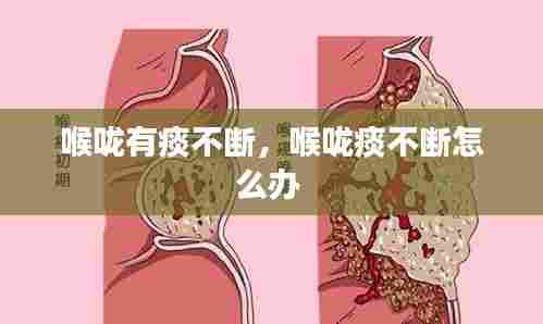 喉咙有痰不断，喉咙痰不断怎么办 