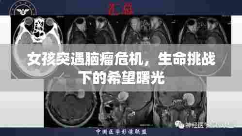 女孩突遇脑瘤危机，生命挑战下的希望曙光