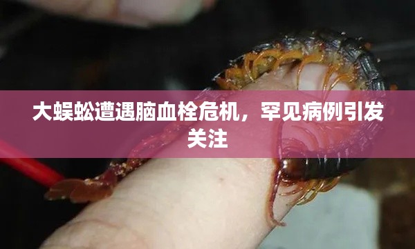 大蜈蚣遭遇脑血栓危机,罕见病例引发关注