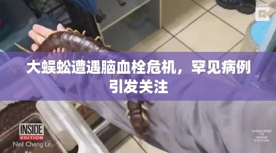 大蜈蚣遭遇脑血栓危机,罕见病例引发关注