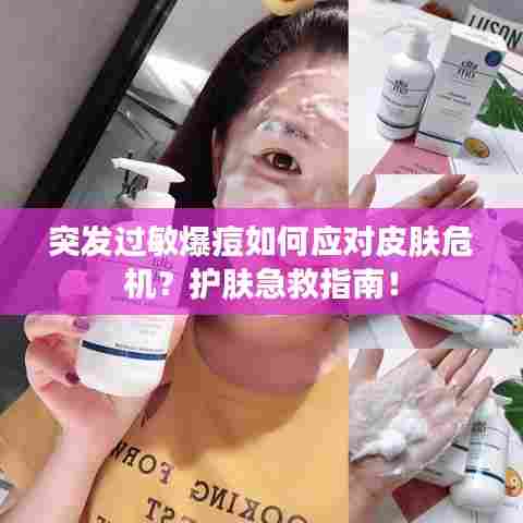 突发过敏爆痘如何应对皮肤危机?护肤急救指南!